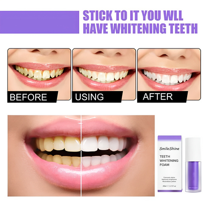 SmileShine | Teeth Color Corrector Serum